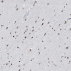 Immunohistochemical staining of human cerebral cortex shows moderate nuclear positivity in glial cells.