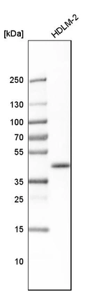Western blot analysis in human cell line HDLM-2.