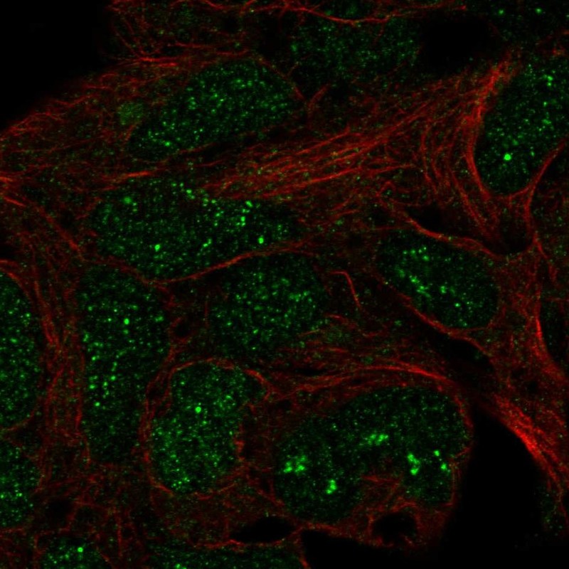 Anti-TRMT11 Antibody