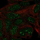 Anti-TRMT11 Antibody