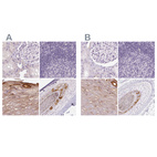 Immunohistochemical staining of human kidney, lymph node, skin and skin, hairy using Anti-RPTN antibody HPA030483 (A) shows similar protein distribution across tissues to independent antibody HPA030485 (B).