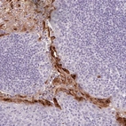 Immunohistochemical staining of human tonsil shows high expression.