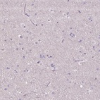 Immunohistochemical staining of human cerebral cortex shows low expression as expected.