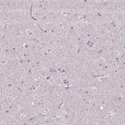 Immunohistochemical staining of human cerebral cortex shows low expression as expected.