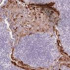 Immunohistochemical staining of human tonsil shows strong cytoplasmic positivity in squamous epithelial cells.