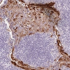 Immunohistochemical staining of human tonsil shows strong cytoplasmic positivity in squamous epithelial cells.