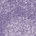 Anti-RPTN Antibody