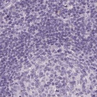 Immunohistochemical staining of human lymph node using Anti-RPTN antibody HPA030483.