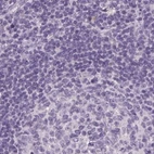 Immunohistochemical staining of human lymph node using Anti-RPTN antibody HPA030483.