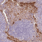 Immunohistochemical staining of human tonsil shows strong cytoplasmic positivity in squamous epithelial cells.