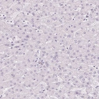 Immunohistochemical staining of human liver shows no positivity in hepatocytes as expected.