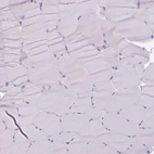 Immunohistochemical staining of human skeletal muscle shows no positivity in myocytes as expected.