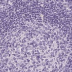 Anti-RPTN Antibody