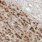 Anti-KCNH5 Antibody