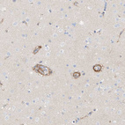 Immunohistochemical staining of human cerebral cortex shows moderate cytoplasmic positivity in endothelial cells.