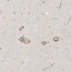 Immunohistochemical staining of human cerebral cortex shows moderate cytoplasmic positivity in endothelial cells.