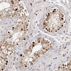 Immunohistochemical staining of human testis shows moderate to strong nuclear positivity in cells in seminiferous ducts.