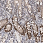 Immunohistochemical staining of human duodenum shows moderate to strong nuclear positivity in glandular cells.