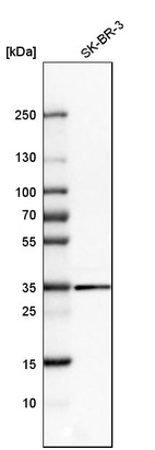 Western blot analysis in human cell line SK-BR-3.