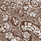 Immunohistochemical staining of human colon shows strong granular cytoplasmic positivity in glandular cells.