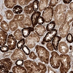 Immunohistochemical staining of human kidney shows strong granular cytoplasmic positivity in cells in tubules.