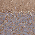 Immunohistochemical staining of human cerebellum shows strong granular cytoplasmic positivity in Purkinje cells.