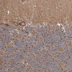 Immunohistochemical staining of human cerebellum shows strong granular cytoplasmic positivity in Purkinje cells.