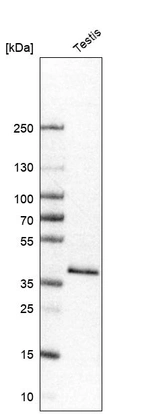Anti-GYG1 Antibody