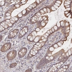 Immunohistochemical staining of human small intestine shows moderate cytoplasmic positivity in glandular cells.