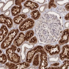 Immunohistochemical staining of human kidney shows strong cytoplasmic positivity in cells in tubules.
