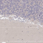 Immunohistochemical staining of human cerebellum shows no positivity in neurons as expected.