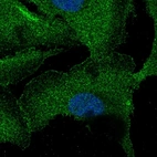 Anti-ZNF785 Antibody