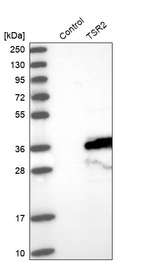 Anti-TSR2 Antibody