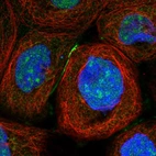 Immunofluorescent staining of human cell line A-431 shows localization to nucleus, nucleoli & cell junctions.