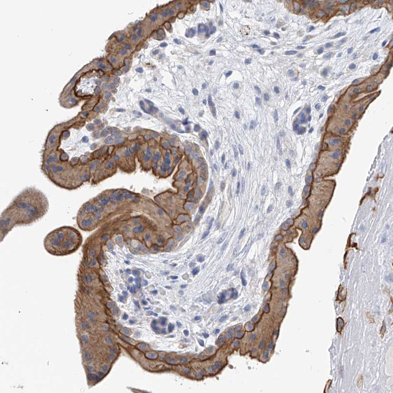 Anti-PIK3C2B Antibody