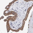 Anti-PIK3C2B Antibody