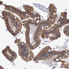 Immunohistochemical staining of human small intestine shows strong membranous positivity in glandular cells.