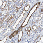 Immunohistochemical staining of human kidney shows strong membranous positivity in subset of cells in tubules.