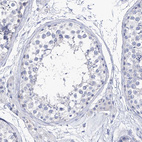 Immunohistochemical staining of human testis shows no positivity in cells in seminiferous ducts as expected.