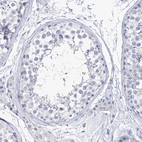 Immunohistochemical staining of human testis shows no positivity in cells in seminiferous ducts as expected.