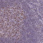 Immunohistochemical staining of human tonsil shows strong nuclear positivity in germinal center cells.
