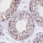 Immunohistochemical staining of human testis shows strong nuclear positivity in cells in seminiferous ducts.