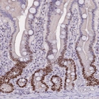 Immunohistochemical staining of human duodenum shows strong nuclear positivity in glandular cells.