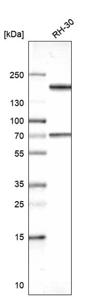 Western blot analysis in human cell line RH-30.