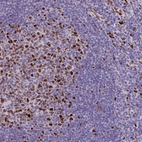 Immunohistochemical staining of human tonsil shows strong nuclear positivity in germinal center cells.