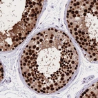 Immunohistochemical staining of human testis shows strong nuclear positivity in cells in seminiferous ducts.