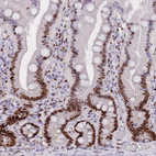 Immunohistochemical staining of human duodenum shows strong nuclear positivity in glandular cells.