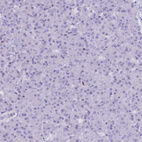 Immunohistochemical staining of human pancreas shows no positivity in exocrine glandular cells as expected.