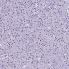 Immunohistochemical staining of human pancreas shows no positivity in exocrine glandular cells as expected.