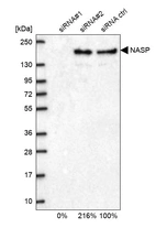 Western blot analysis in U2OS cells transfected with control siRNA, target specific siRNA probe #1 and #2, using Anti-NASP antibody. Remaining relative intensity is presented.